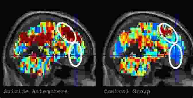Brain Scan Showing Political Bias Activation Mending America S Political Divide: What Science Tells Us About Solving The Political Hatred Between The Left And The Right