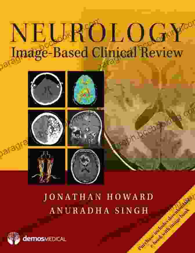 Neurology Image Based Clinical Review By Jonathan Howard, MD Neurology Image Based Clinical Review Jonathan Howard MD
